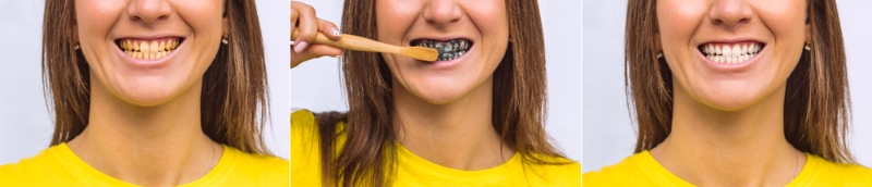 activated charcoal teeth whitening before and after