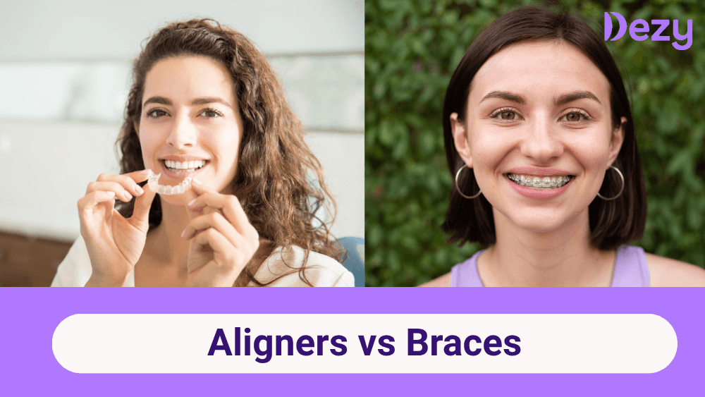 Braces vs. Aligners: Which Is Best for Your Perfect Smile?