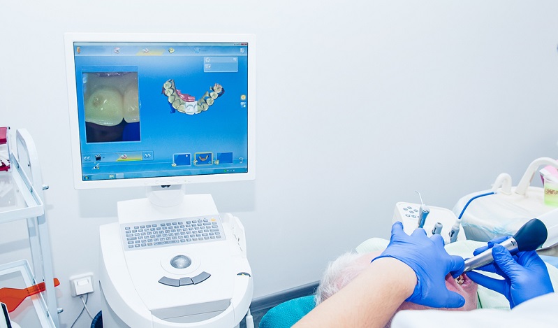 What is CAD CAM Dentistry? - Definition, Uses, Pros, and Cons