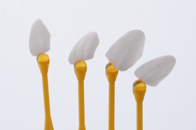 Ceramic Veneers: A Comprehensive Guide to a Dazzling Smile