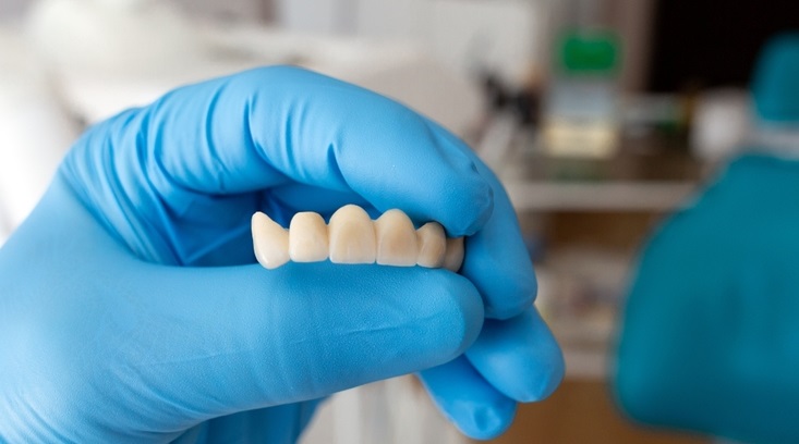 Dental Bridge: Why You Need Them, Procedure, Advantages & Treatment