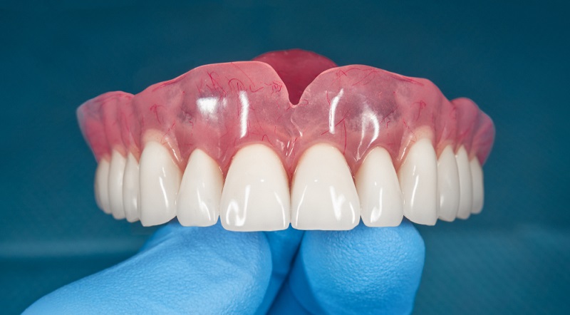 Alternatives to Dental Implants: Best Options to Consider