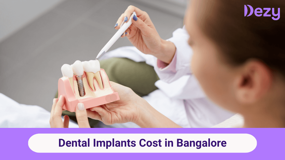 Dental Implants Cost in Bangalore | Average Prices Explained
