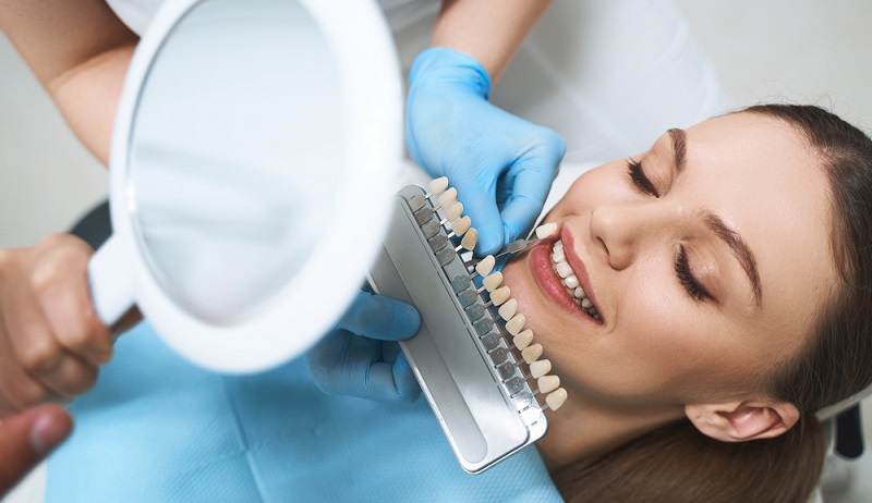 Veneers Teeth Pros and Cons: Here’s What You Need To Know!