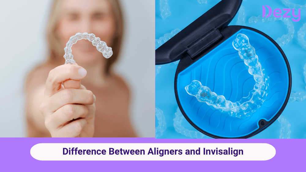Difference Between Aligners and Invisalign: Which Is Right for You?