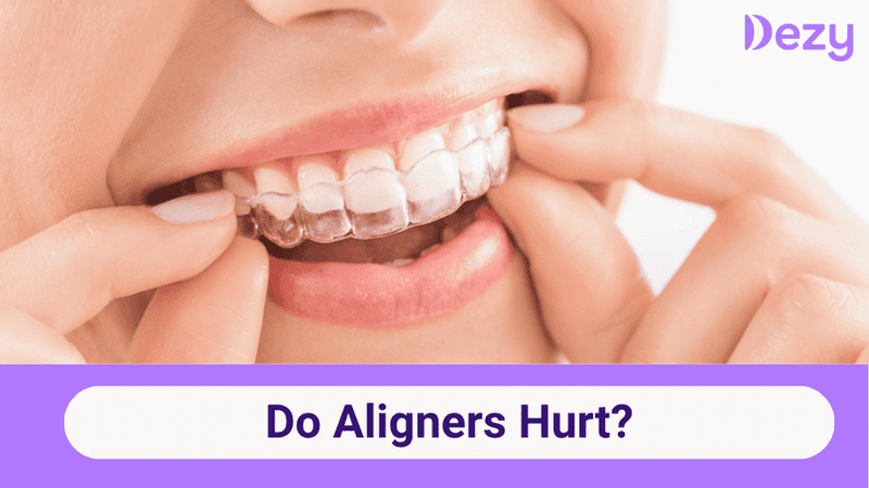 Do Aligners Hurt? Causes, Duration and Relief Guide