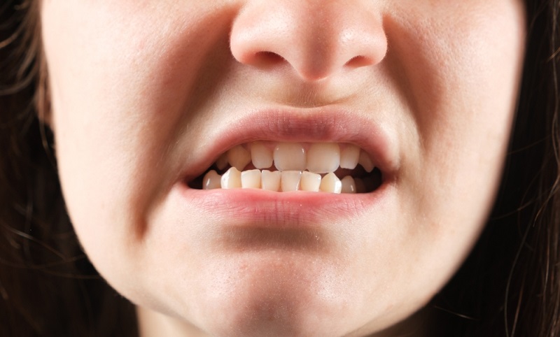 Lower Jaw (Mandible): Anatomy, Functions, and Remedies for Pain Relief