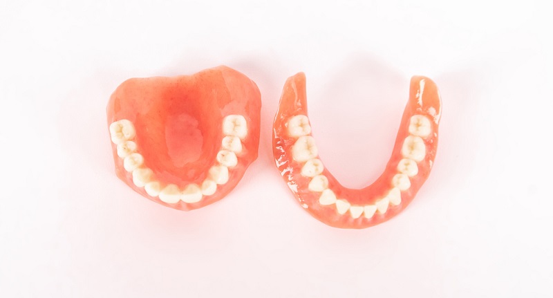 A Beginner's Guide to Mini Dental Implants: What You Need to Know