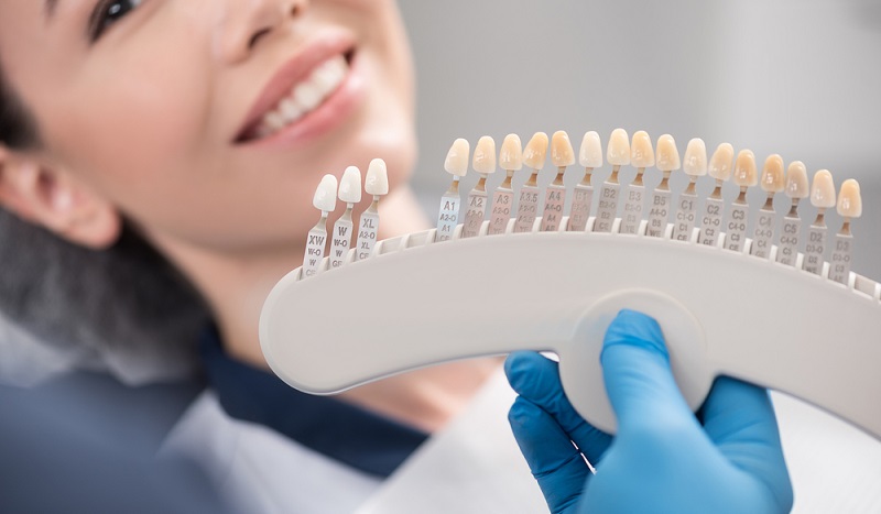 Porcelain Veneers: Procedure, Costs, & Benefits You Should Know