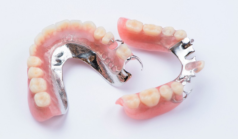 rpd removal partial dentures types cost 