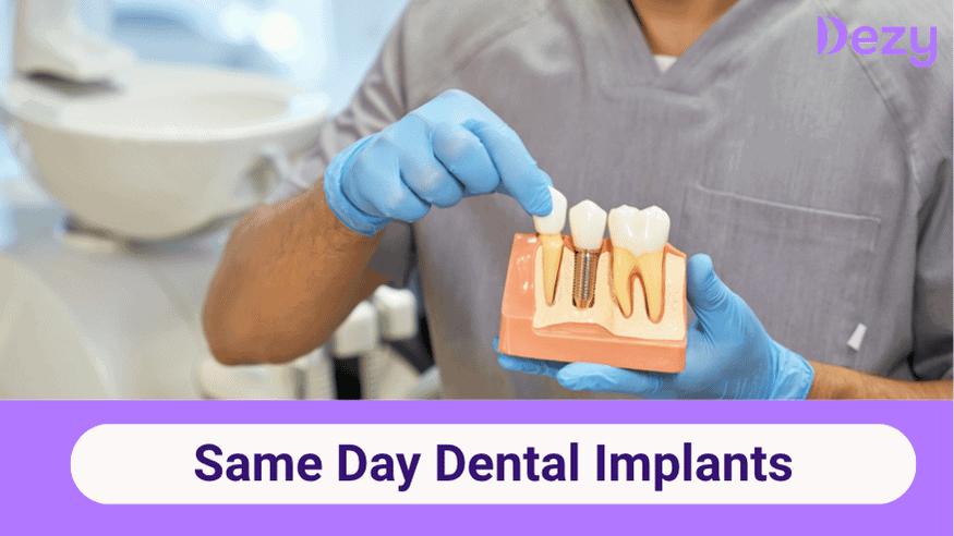 What are Same-Day Dental Implants? Everything You Should Know