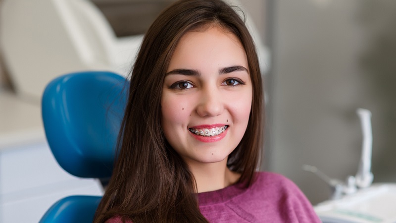 teeth braces age limit