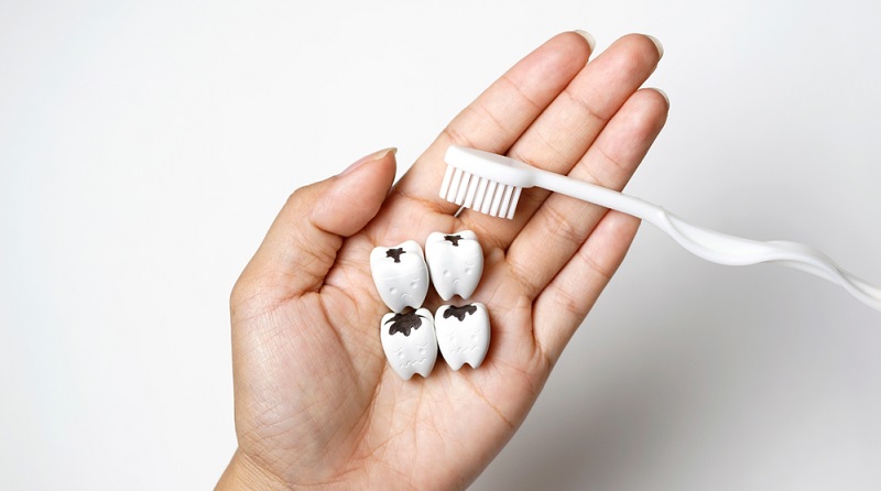How to Prevent Tooth Decay Naturally?