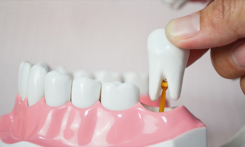 What Age Do Wisdom Teeth Come in and What Triggers Them to Grow?