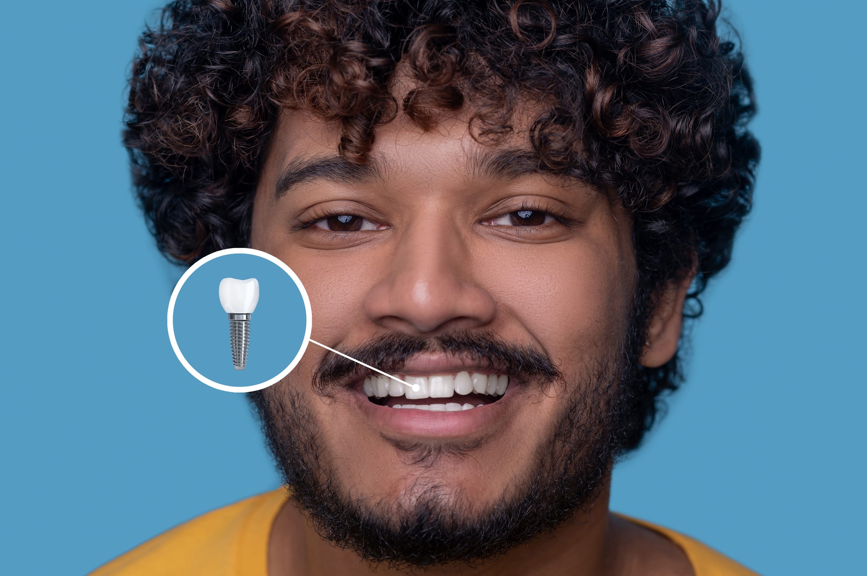 Bad Dental Implants: 7 Warning Signs of Dental Implant Failure You Shouldn't Ignore