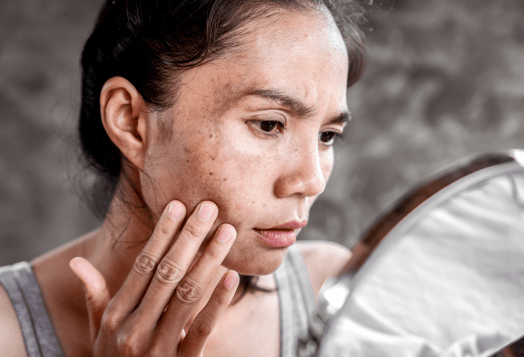 A woman looking in a mirror at her facial skin problems