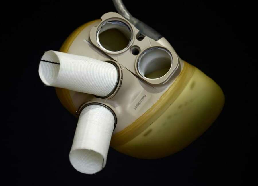 Artificial heart maker Carmat&#8217;s shares slide on $11.5 million capital hike