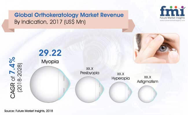 The Global Orthokeratology Market will possibly reach the revenue worth US$ 88.7 Mn through 2028