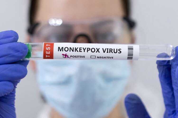 Monkeypox emergency could last months, with window closing to stop spread, experts say
