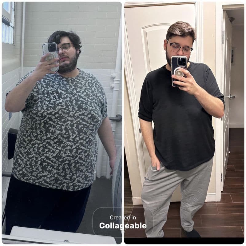 wegovy antes e depois 2